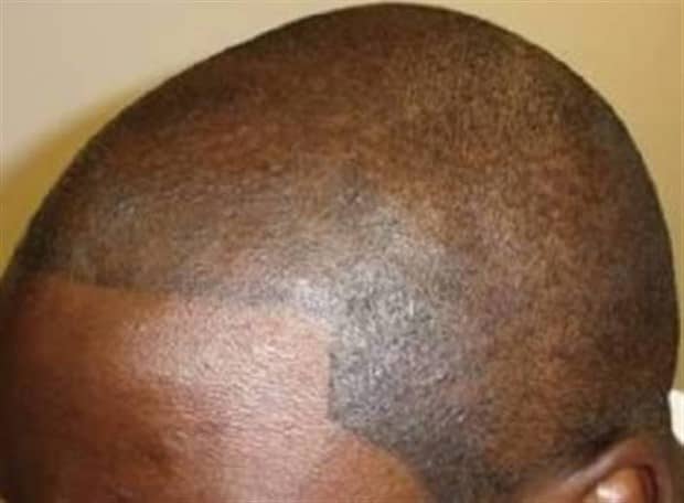 Hair Tattoos That Made It Worse (17 photos)