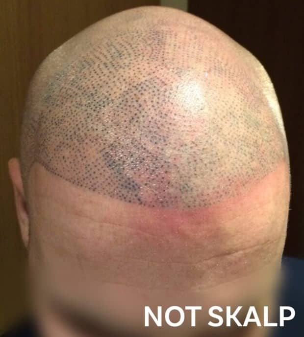 Hair Tattoos That Made It Worse (17 photos)