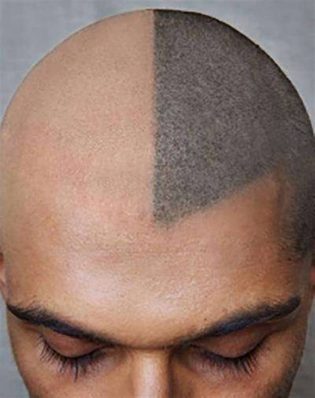 Hair Tattoos That Made It Worse (17 photos)