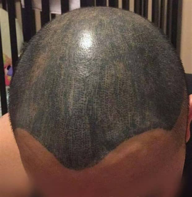 Hair Tattoos That Made It Worse (17 photos)
