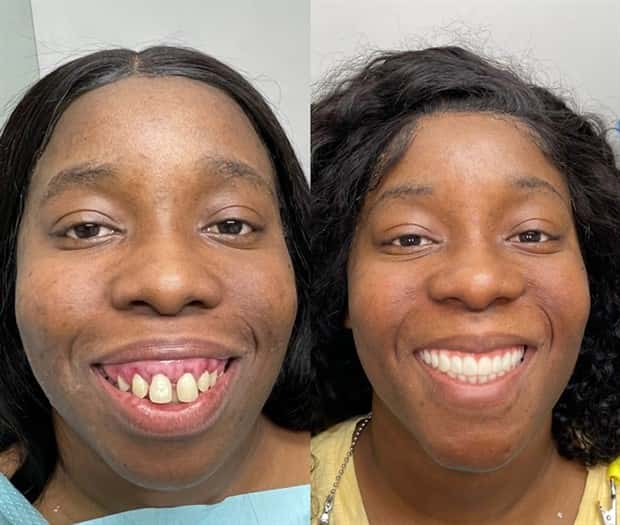 best dental implants 1 Proper Dental Implants Can Transform Any Face (20 photos)
