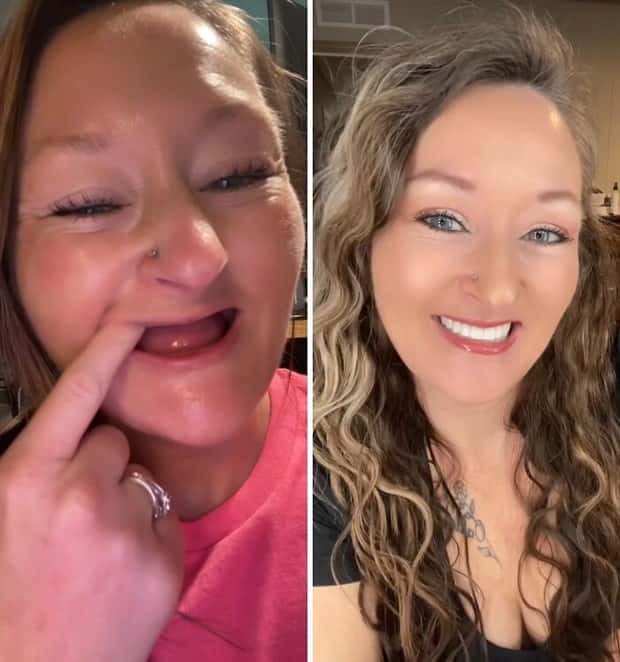 best dental implants 9 Proper Dental Implants Can Transform Any Face (20 photos)