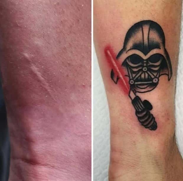 Creative Cover Ups for Scars and Failed Tattoos (23 photos)