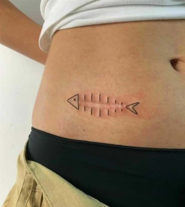 Creative Cover Ups for Scars and Failed Tattoos (23 photos)