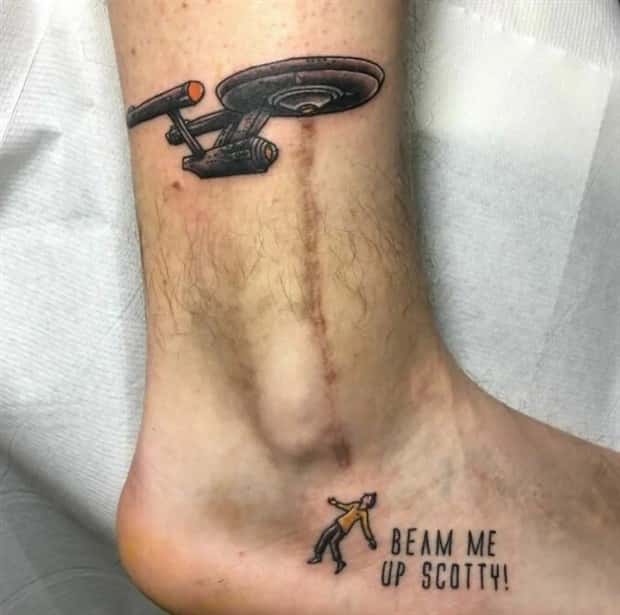 Creative Cover Ups for Scars and Failed Tattoos (23 photos)