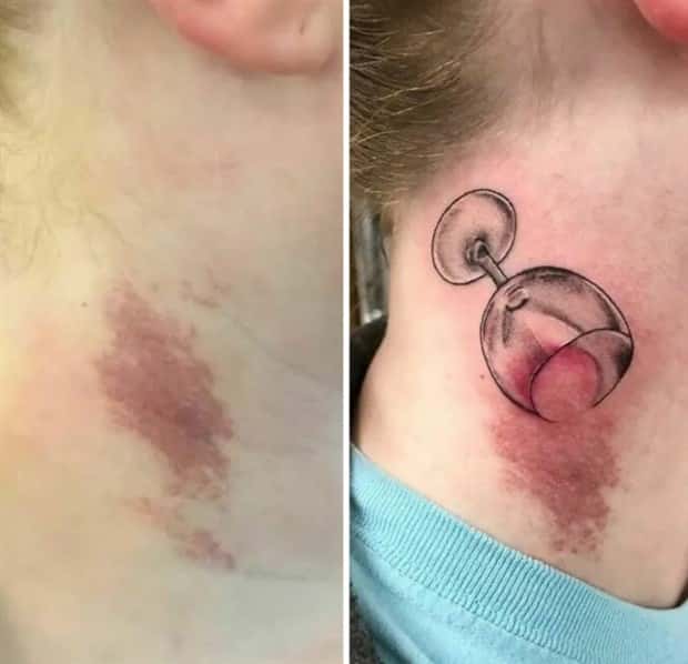 Creative Cover Ups for Scars and Failed Tattoos (23 photos)