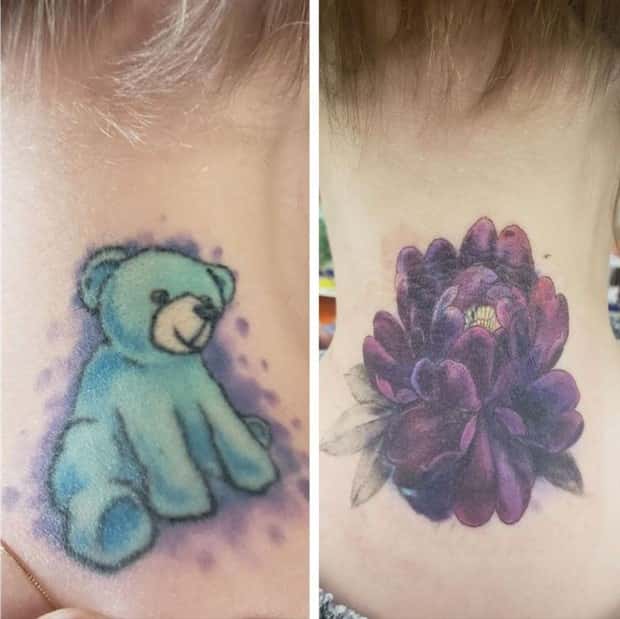 Creative Cover Ups for Scars and Failed Tattoos (23 photos)