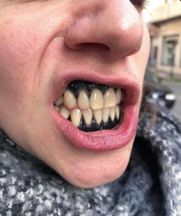 Crappy Tattoos that Shouldn’t Have Been Done #40 (20 photos)