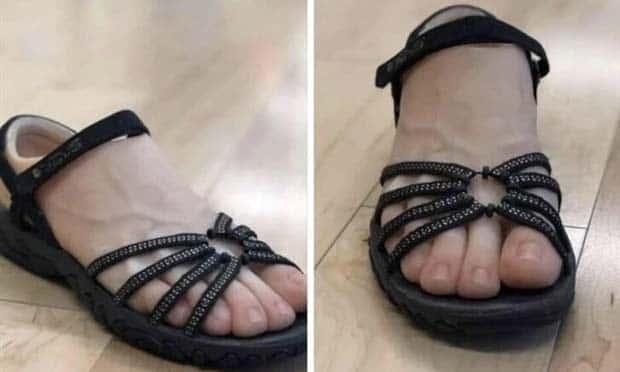 cringeworthy footwear 7 Cringeworthy Shoes That Leave Lasting Impressions (20 photos)