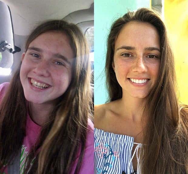 ugly ducklings 15 These People Were Once Ugly Ducklings (37 photos)