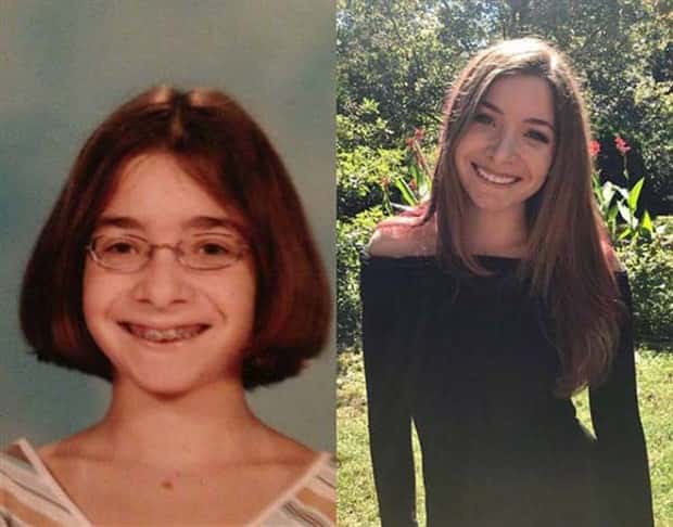 ugly ducklings 17 These People Were Once Ugly Ducklings (37 photos)