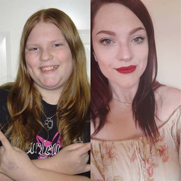 ugly ducklings 21 These People Were Once Ugly Ducklings (37 photos)