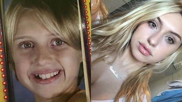 ugly ducklings 22 These People Were Once Ugly Ducklings (37 photos)