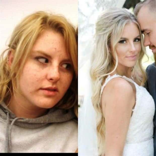 ugly ducklings 23 These People Were Once Ugly Ducklings (37 photos)