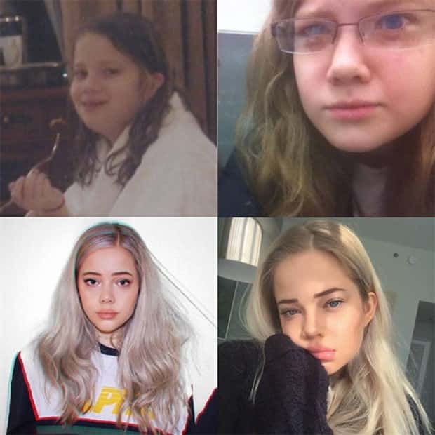 ugly ducklings 25 These People Were Once Ugly Ducklings (37 photos)