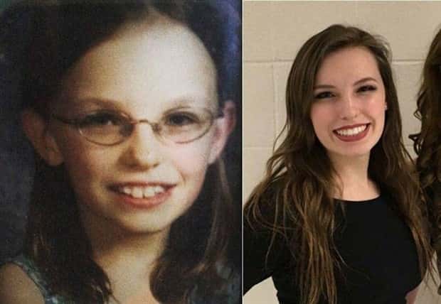 ugly ducklings 32 These People Were Once Ugly Ducklings (37 photos)