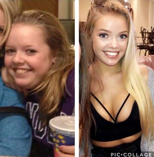 ugly ducklings 34 These People Were Once Ugly Ducklings (37 photos)