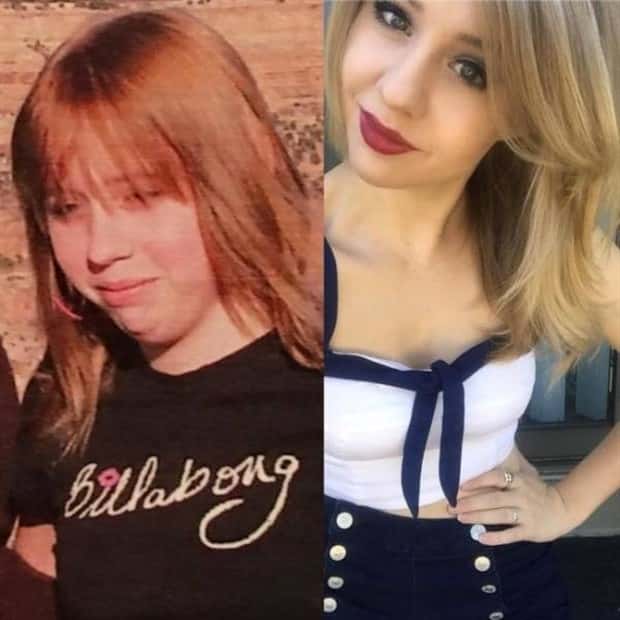 ugly ducklings 36 These People Were Once Ugly Ducklings (37 photos)