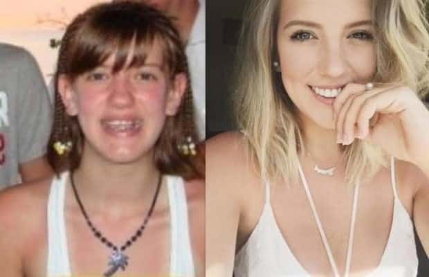 ugly ducklings 37 These People Were Once Ugly Ducklings (37 photos)
