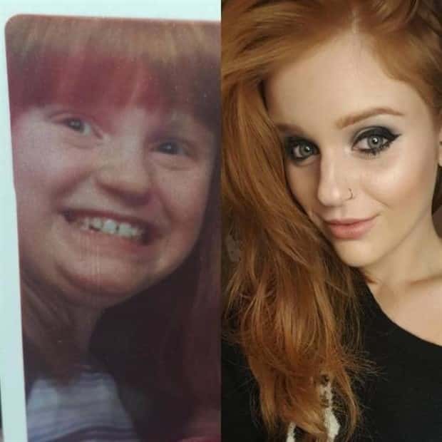 ugly ducklings 4 These People Were Once Ugly Ducklings (37 photos)