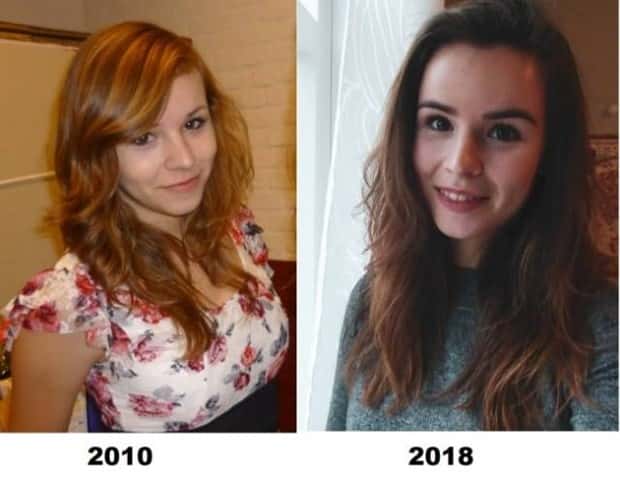 ugly ducklings 5 These People Were Once Ugly Ducklings (37 photos)