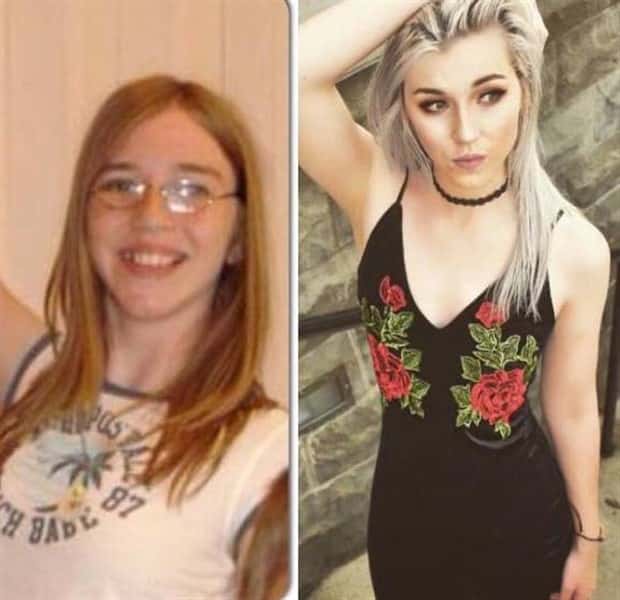 ugly ducklings 6 These People Were Once Ugly Ducklings (37 photos)