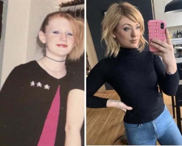 ugly ducklings 7 These People Were Once Ugly Ducklings (37 photos)