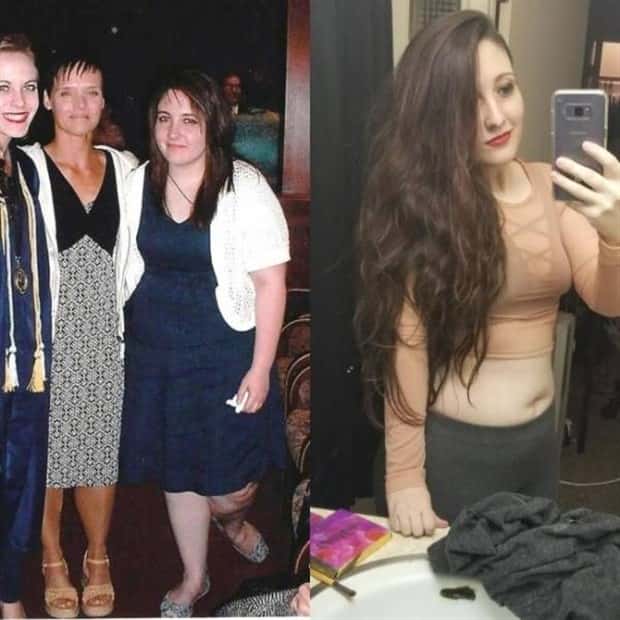 ugly ducklings 8 These People Were Once Ugly Ducklings (37 photos)