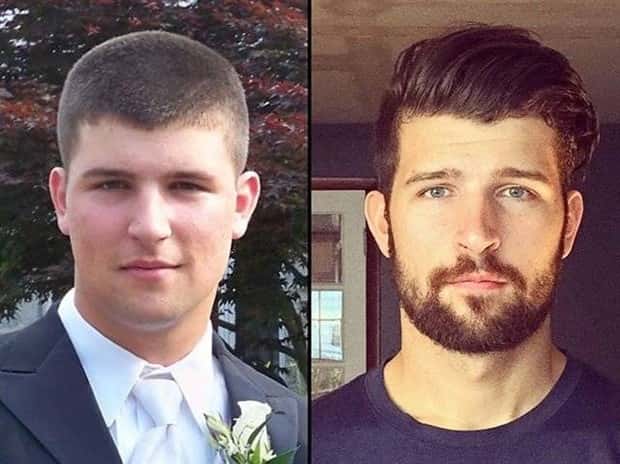 ugly ducklings 9 These People Were Once Ugly Ducklings (37 photos)