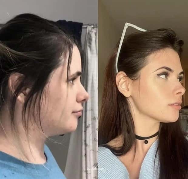 weight loss (1)
