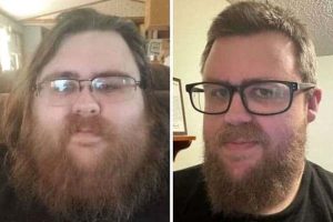 Yes, Weight Loss is Possible #6 (20 photos)