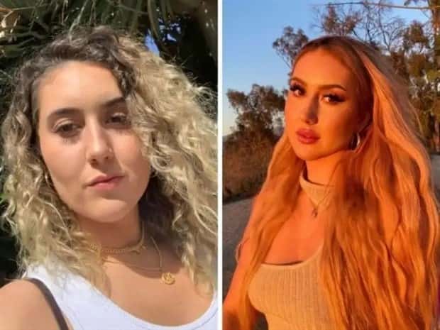 faces after plastic surgery (10)