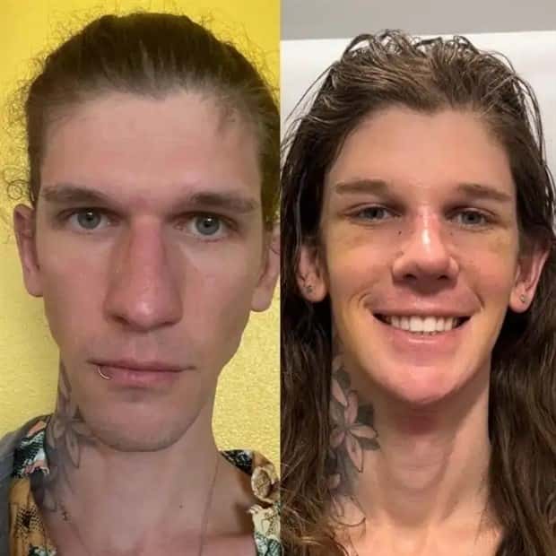 faces after plastic surgery (11)