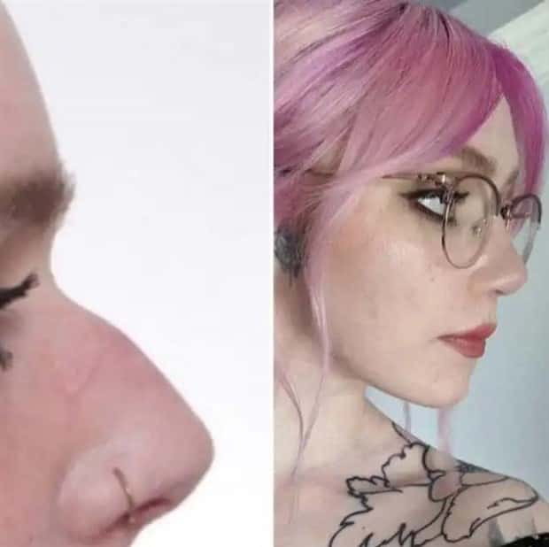 faces after plastic surgery (12)