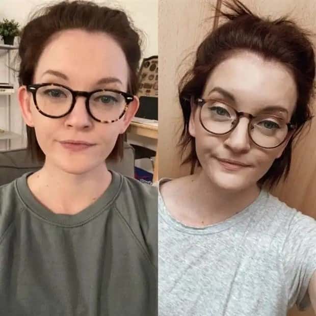 faces after plastic surgery (13)