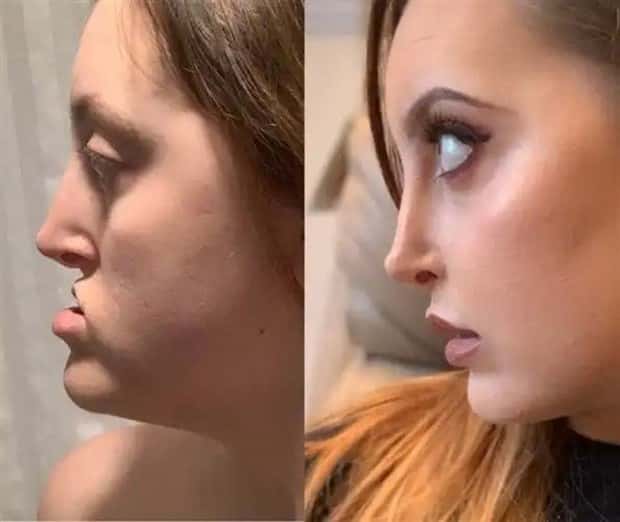 faces after plastic surgery (3)