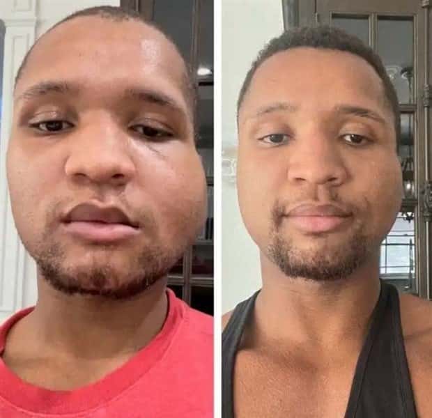 faces after plastic surgery (6)