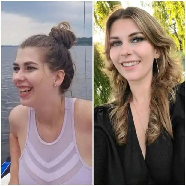 faces after plastic surgery (8)