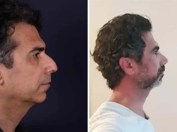 faces after plastic surgery (9)